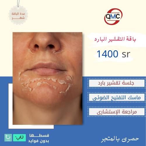 باقة التقشير البارد ( جلسة تقشير بارد +ماسك التفتيح الضوئي+مراجعة  الاستشاري )