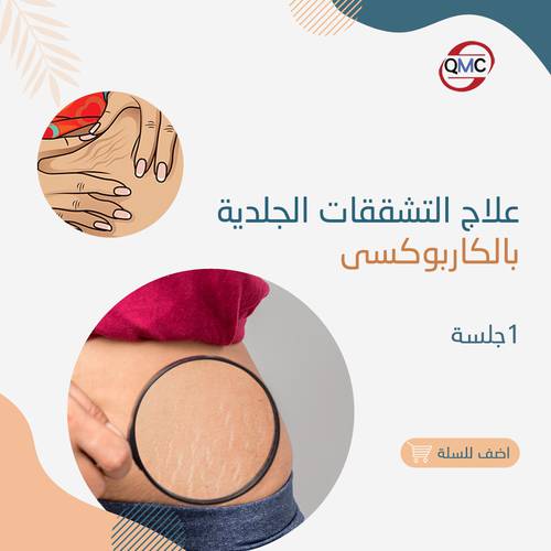 جلسة تجميل التشققات الجلدية بالكاربوكسي 