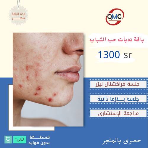 باقة ندبات حب الشباب ( جلسة فراكشنال ليزر +بلازما ذاتية +مراجعة الاستشاري )