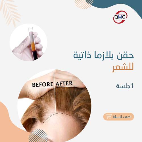 جلسة بلازما ذاتية للشعر 
