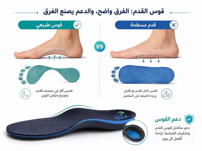 القدم المسطحة (الفلات فوت): الأعراض والأسباب وكيف تدعمها
