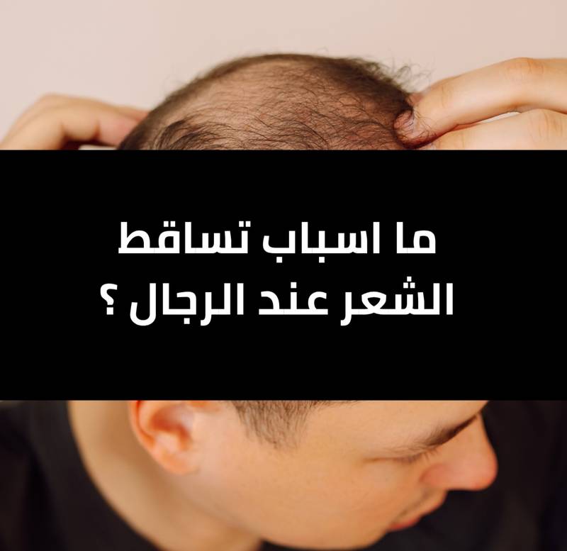 ما اسباب تساقط الشعر عند الرجال؟ الدليل الشامل لفهم الأسباب والعلاج