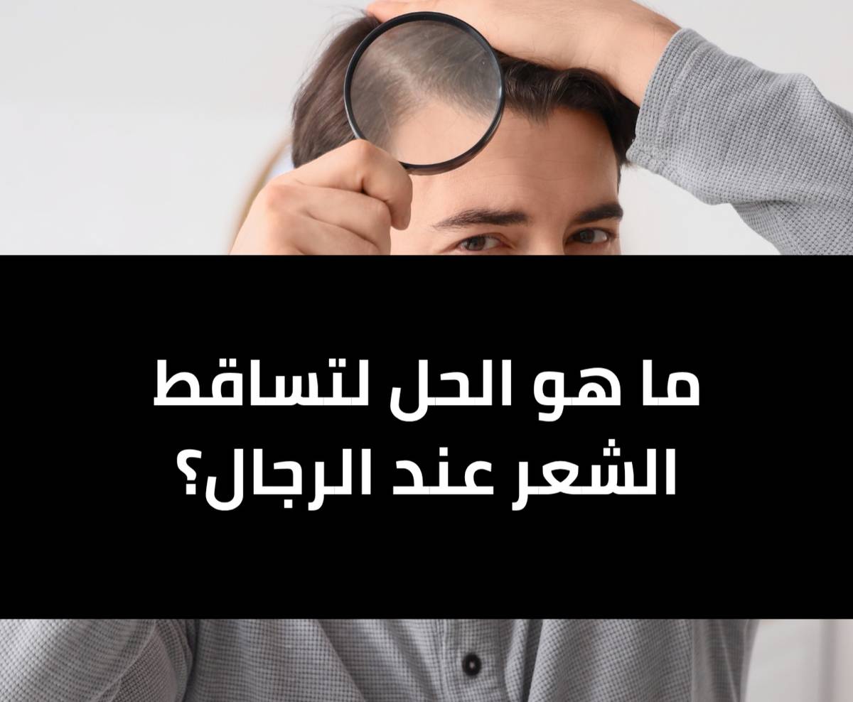 ما هو الحل لتساقط الشعر عند الرجال ؟