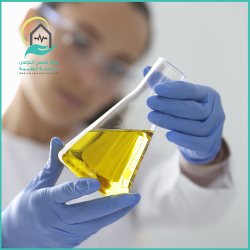 تحاليل التهاب البول ( لا تتطلب صيام )