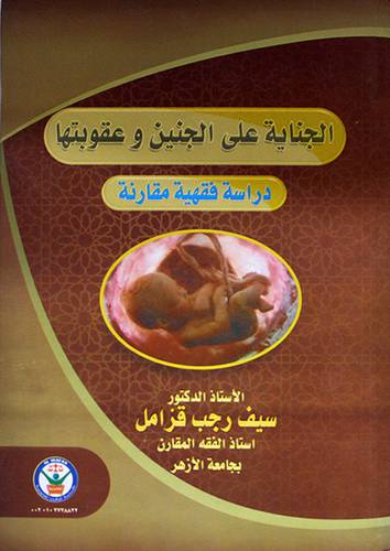 الجناية على الجنين وعقوبتها ( كرتونى)