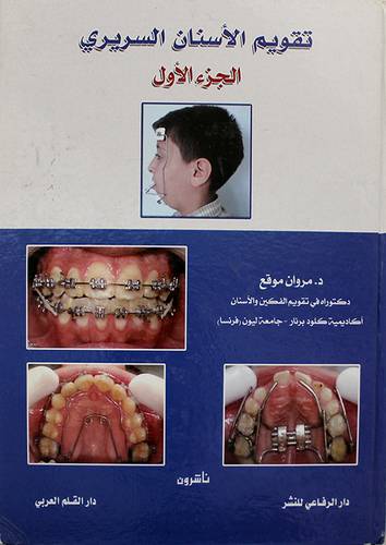 تقويم الاسنان السريرى 2/1 (كرتونى)