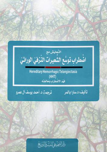 التعايش مع اضطراب توسع الشعيرات النزفي الوراثي (غلاف) شاموا