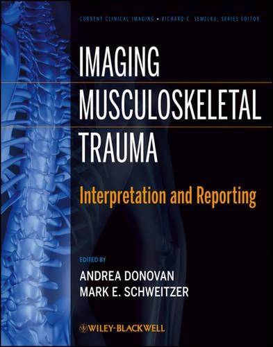 imaging musculoskeletal trauma
