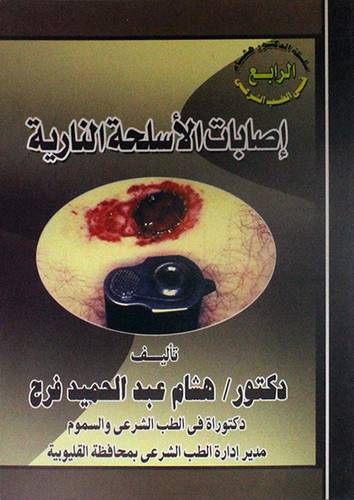 اصابات الاسلحة النارية