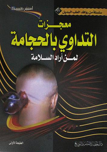 سلسلة من روافد الطب البديل (11) التداوى بالحجامة لمن اراد السلامة