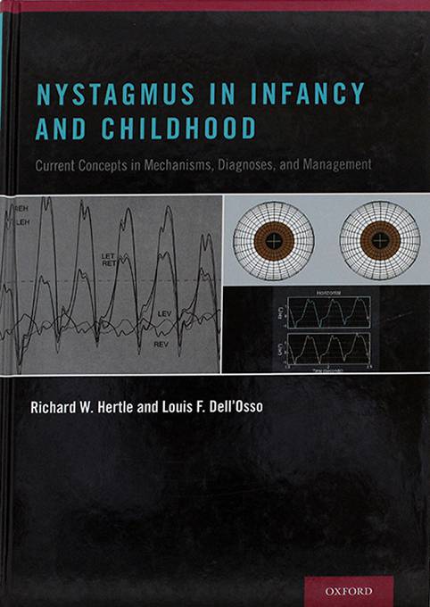 NYSTAGMUS IN INFANCY AND CHILDHOOD