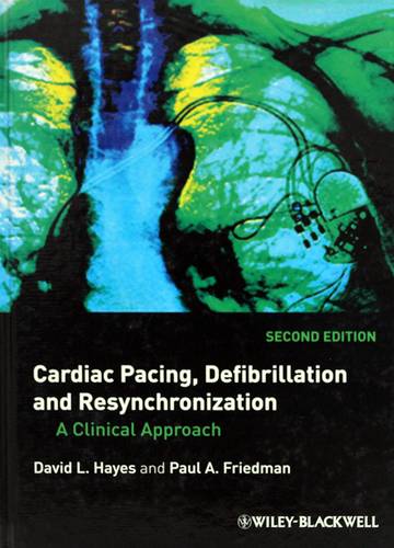 CARDIAC PACING DEFIBRILLATION & RESYNCHRONIZATION -SECOND EDITION