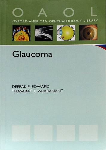 Glaucoma (Oxford American Ophthamology Library