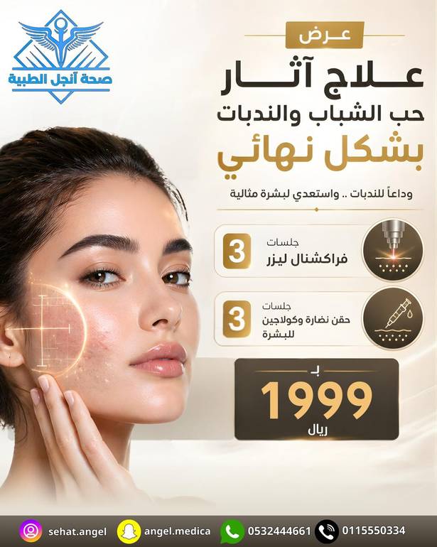 علاج آثار حب الشباب و الندبات بشكل نهائي