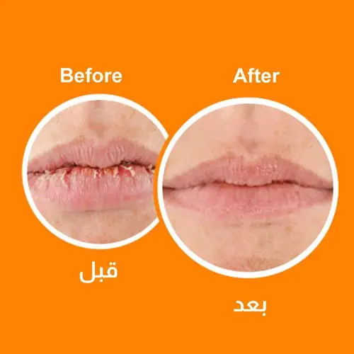 بلسم إصلاح الشفاه الجافة والمتشققة مع واقي شمس SPF15 من اوكيفيز , 4.2 جم