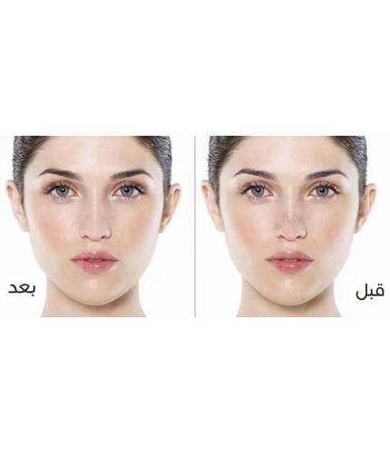 كيلان لصقات منظفة للأنف 4 قطع
