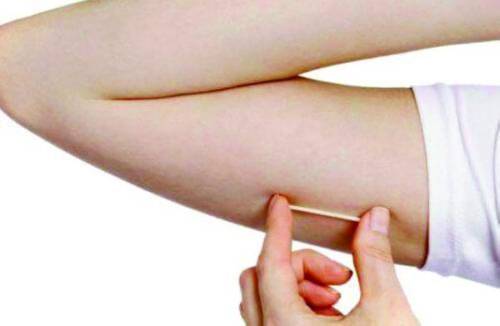 شريحة منع الحمل إمبلانون