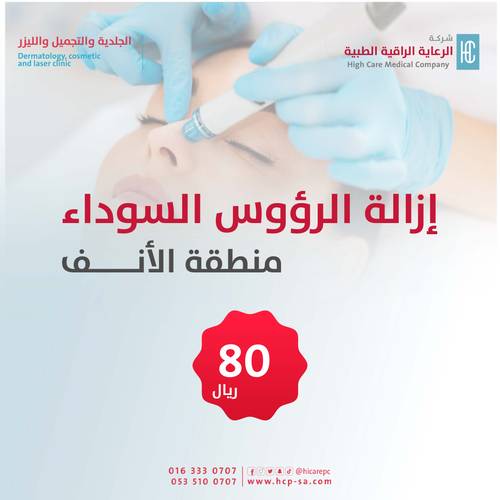 إزالة الرؤوس السوداء - للنساء 