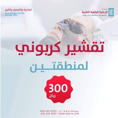 تقشير كربوني لمنطقتين