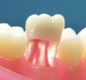 Transparent Endodontic training teeth