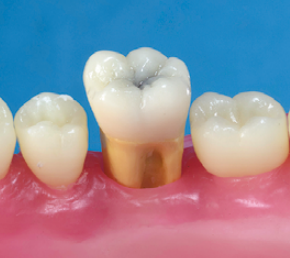 Radiopaque Endodontic Training teeth