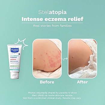 Mustela Stelatopia Emollient Face Cream for Very Dry & Atopic Skin 40ml